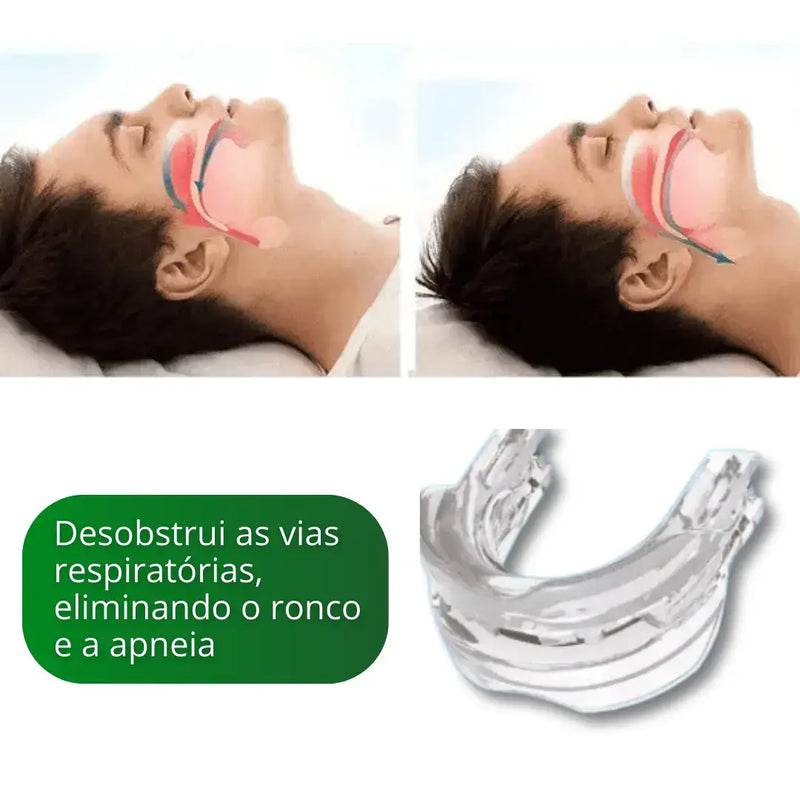 Aparelho Bucal Anti Ronco e Bruxismo SleepMax® - 40% OFF