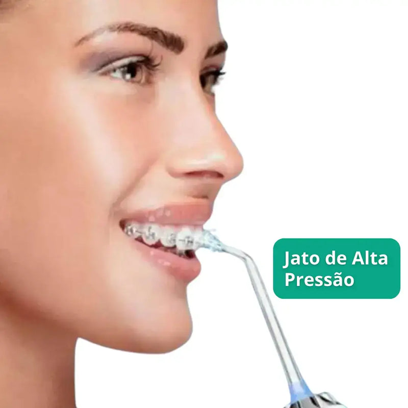 Irrigador Oral PowerClean® - Limpeza Completa de Próteses e Implantes [40% OFF]